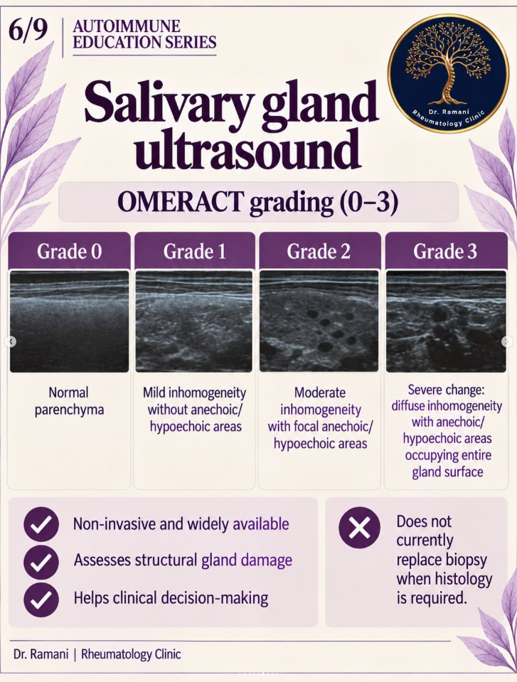 Dr Ramani's salivary gland ultrasound guide showing OMERACT Grades 0 to 3.