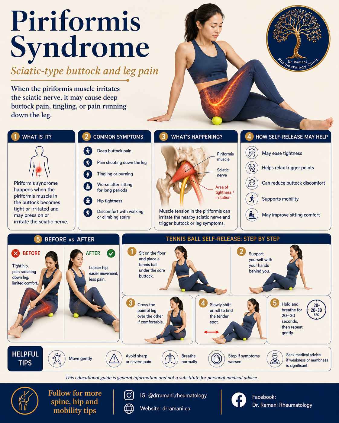 Illustrated patient guide showing the piriformis muscle, sciatic nerve, common symptoms and a step-by-step tennis ball self-release routine.