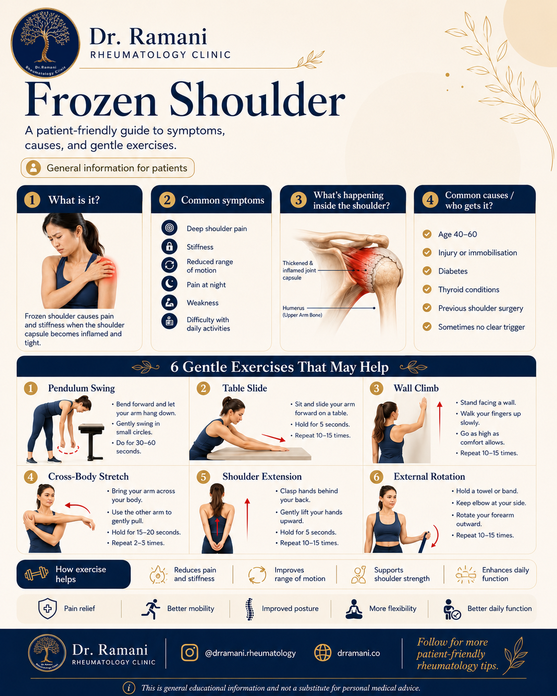 Frozen shoulder infographic: symptoms, thickened inflamed joint capsule, common causes, and six gentle exercises including pendulum swing, table slide, wall climb, cross-body stretch, shoulder extension and external rotation